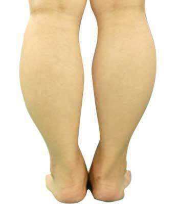 明明很瘦但是腿粗怎么办,天生腿粗可以变成筷子腿吗