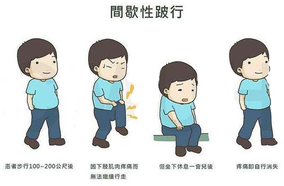 腰椎间盘突出的正确认识,腰椎间盘突出十大禁忌运动