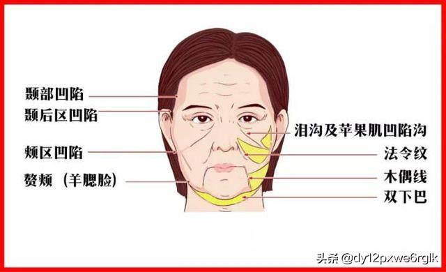 小切口除皱视频教程,小切口除皱术的优势有哪些