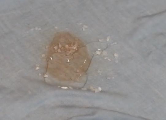 如何去除床单上顽固血渍,床单上的新鲜血渍怎样快速清除