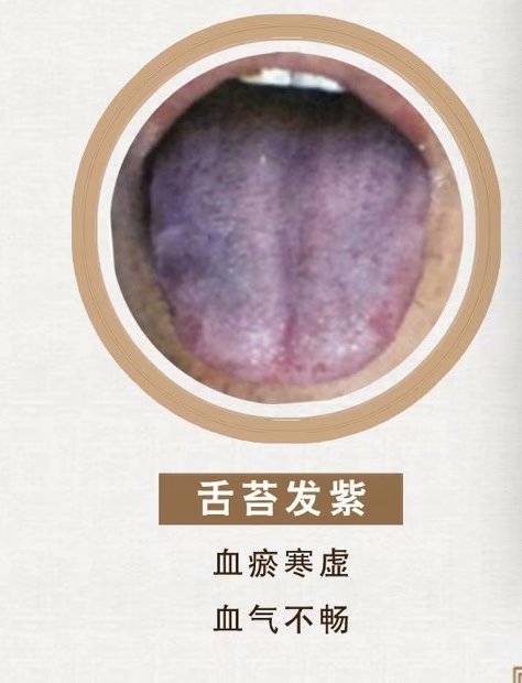 舌诊脉诊分析合集,舌诊实战分析