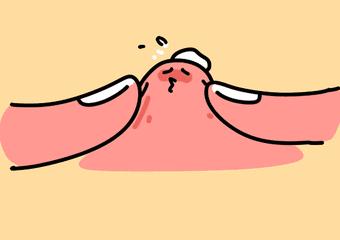 鍋氱編瀹瑰幓姣涘瓟绮夊埡榛戝ご鐥涘悧,鍋氱編瀹圭鐥樺潙