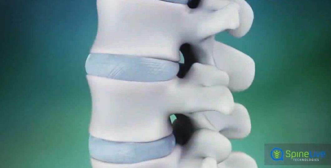 强直不锻炼,强直可以不吃药仅靠锻炼吗