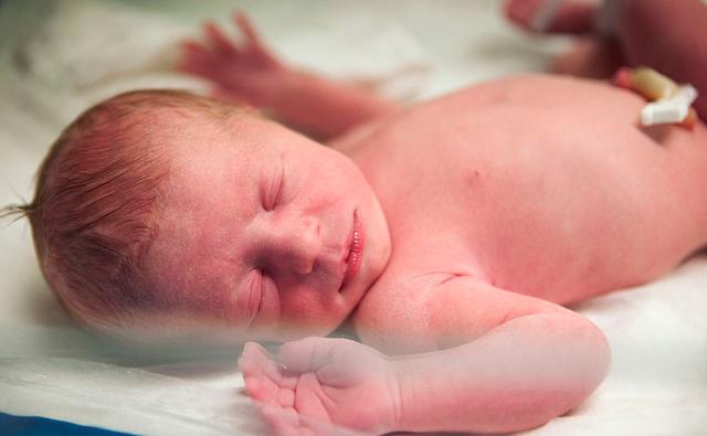 小宝宝湿疹严重怎么处理,湿疹半夜特别痒有什么小妙招