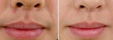 不能说的秘密男女体毛打理指南