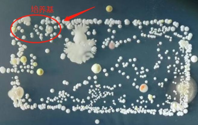 你们的痘痘最后都是怎么完全好的？反正我是用了这个方法才好的