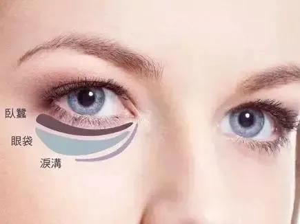 眼袋是怎样治疗,眼袋有什么解决方法