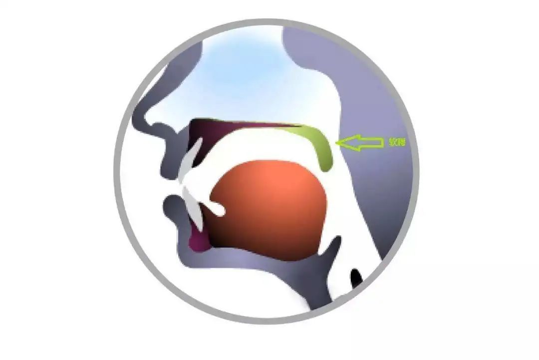 腭隐裂挂什么科,先天性的腭隐裂图片