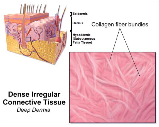 难看又难缠的肥胖纹，要如何预防和去除呢？