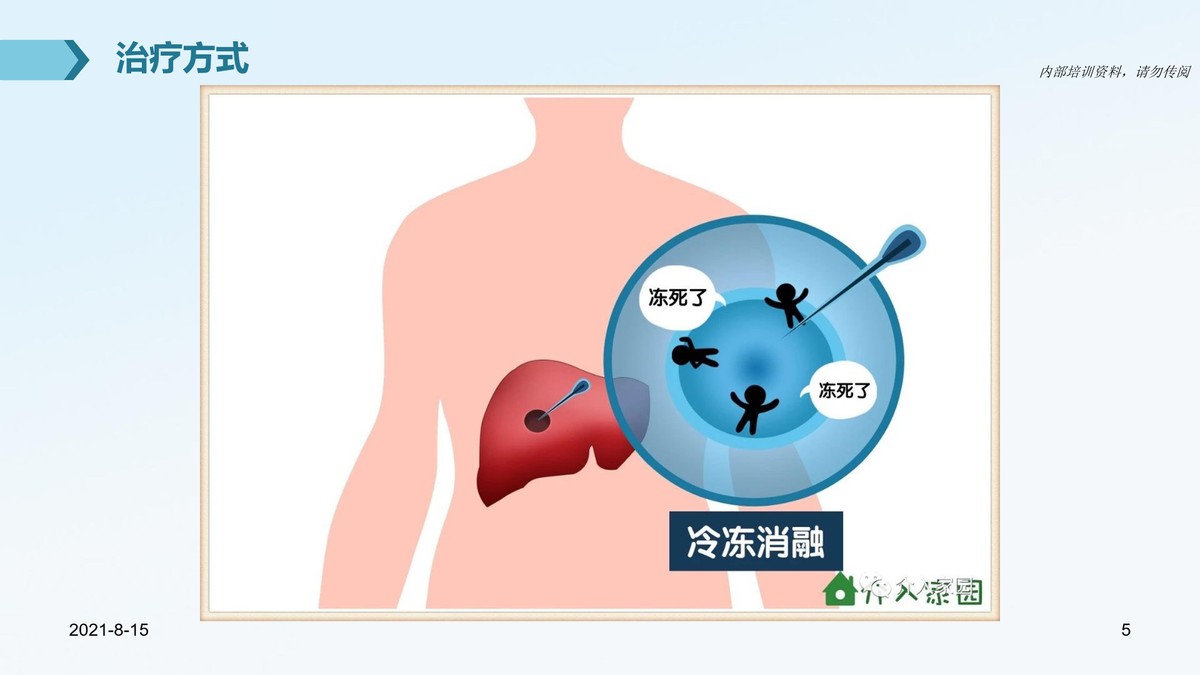 氩氦刀适合早期的肿瘤的切除么,氩氦刀肿瘤治疗新方法