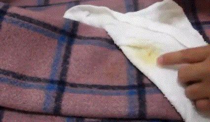 棕色衣服有霉斑怎么办,不是纯白的衣服有霉斑怎样去除