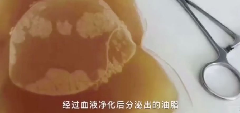 那些坑爹的网红减肥方法大揭秘,跟着女明星吃东西变美