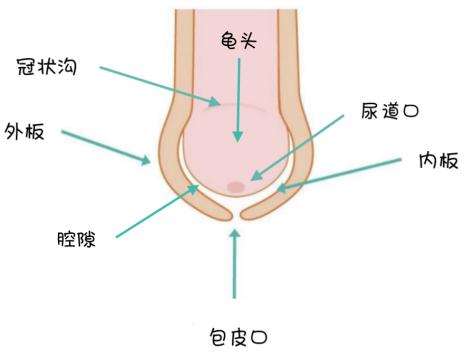 暑假来临，到底要不要带孩子去割包皮？