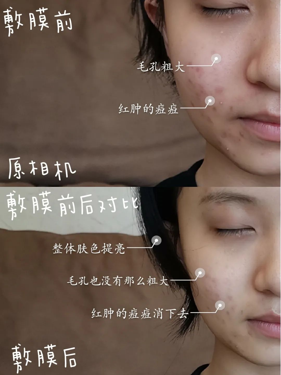 小玛急救水怎么用,小玛急救水好用吗