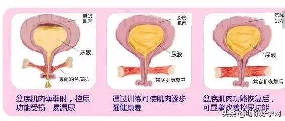 阴道松弛不够紧？一招让你“性”福又美满！