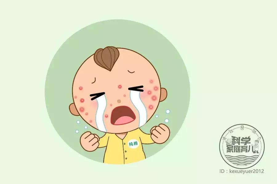 孩子全脸上身上长了疹子,小孩容易出现的各类疹子