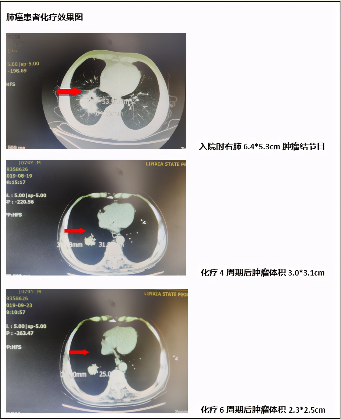 临夏州医院普通内科专家,临夏县人民医院