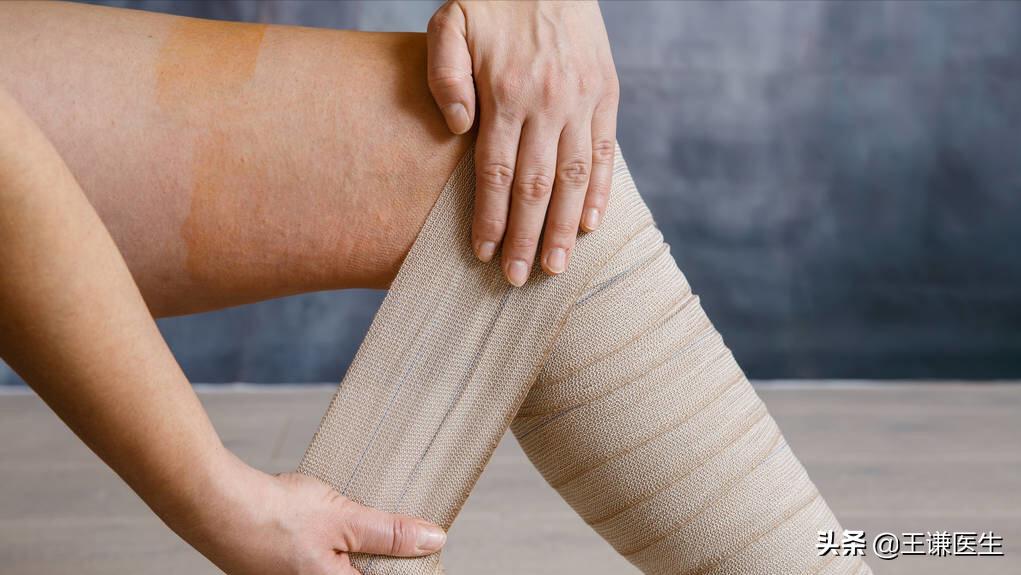 治静脉曲张的弹力袜选几级,静脉曲张弹力袜怎么挑选