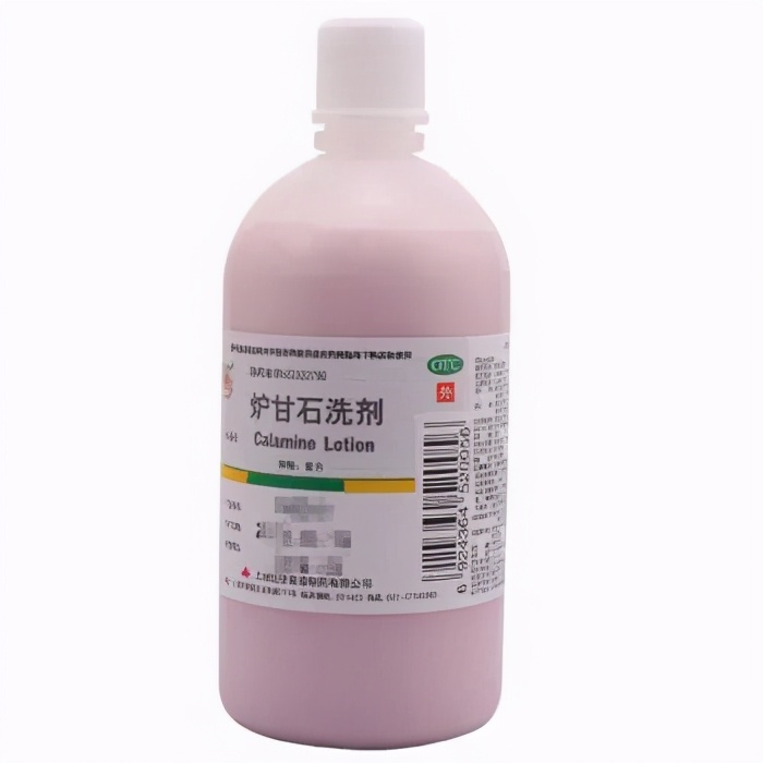 外用止痒药是通过什么原理止痒的,外用止痒效果最好的药