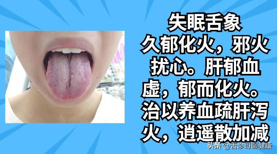 各种舌象分析病情,舌诊哥是如何治疗病人的