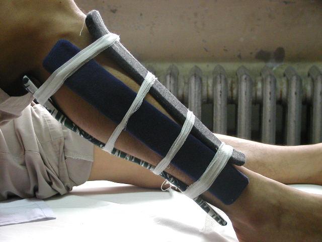 你知道伤筋动骨一百天，但不知道骨折要这样护理，恢复得又快又好