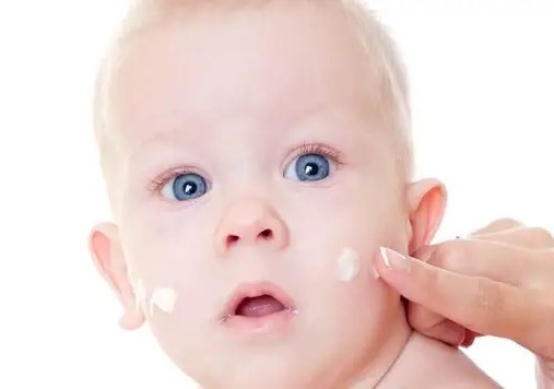 宝宝湿疹哺乳妈妈有必要忌口吗,宝宝湿疹都是妈妈的错