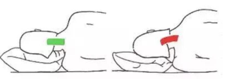 颈椎咔咔响伴有头晕是怎么回事,颈部咔咔声