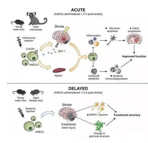 干细胞治疗脑中风后遗症最新消息,干细胞疗法根治高血压在北京