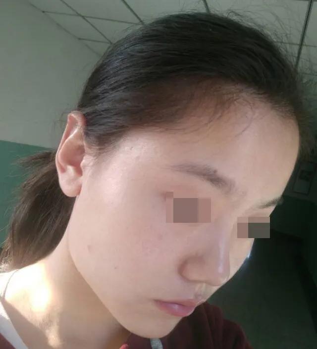 下颌宽大怎么办,下颌宽大导致方脸