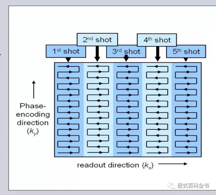 dwi成像序列,dwi序列和edwi序列