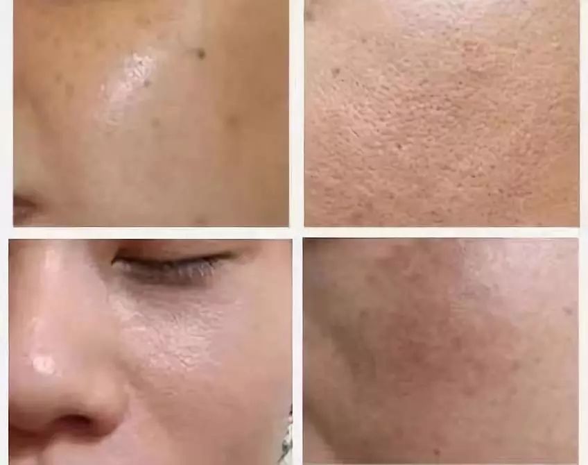 熬最深的夜，也要发最亮的光！烟酰胺精华，让你熬夜也有少女颜