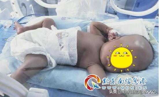 皮包骨变萌娃！丹寨县人民医院成功救治一名重度营养不良患儿