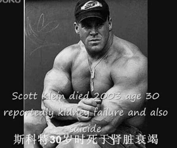 健美运动员意外去世,奥赛健美哪位选手去世了