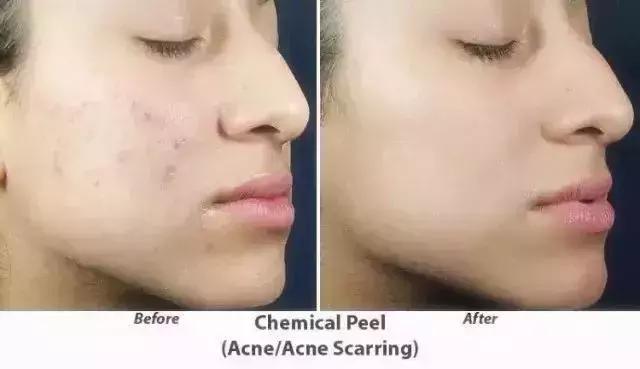 高圆圆40岁生孩子了吗,高圆圆40岁才生女儿