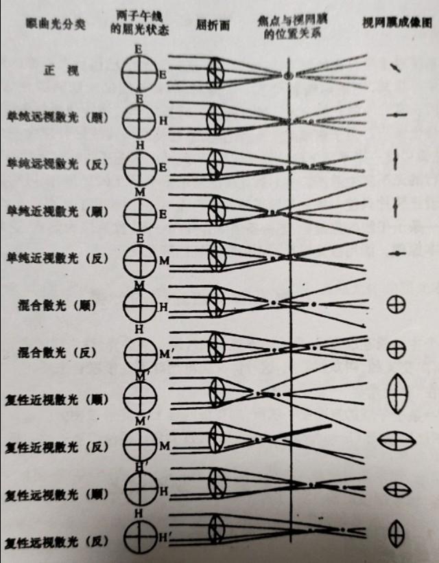 大多数人都是散光,很多人其实都不知道自己散光