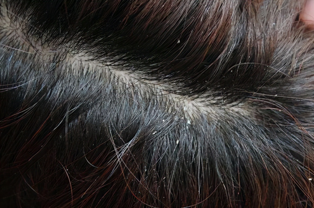 男人用的枕头发黄洗不掉,为什么男人用的毛巾枕头都会发黄