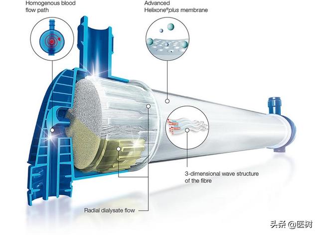 血液透析技术理论与应用,血液透析新技术新进展
