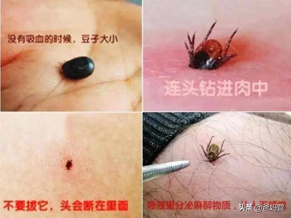 妈妈一拍小孩差点毁容,妈妈拍到孩子的恐怖画面