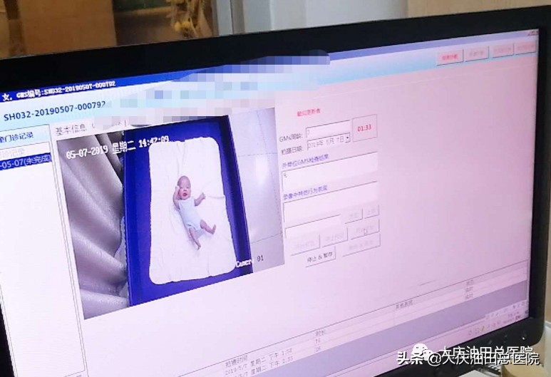 全身运动gms录像评估可靠吗,gms全身运动评估靠谱吗