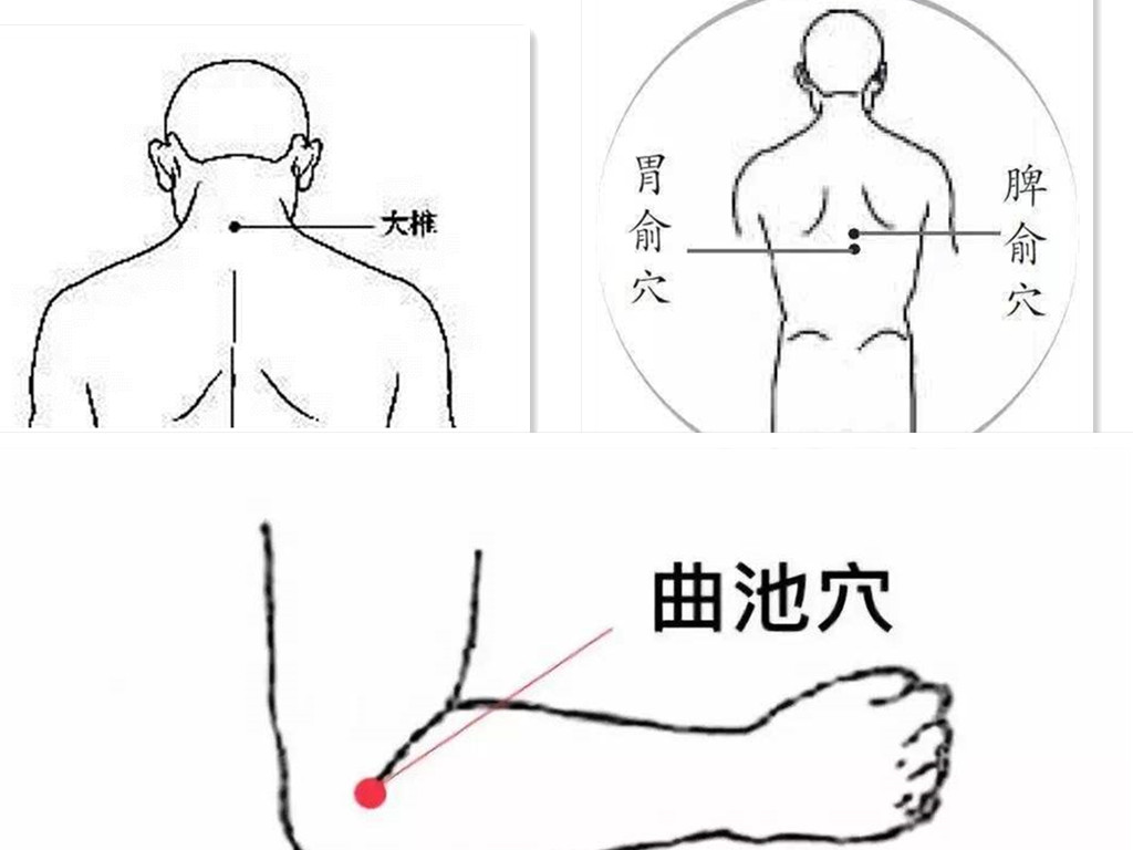 连续上班累成狗谨慎患上周期性瘫痪——宏世堂今日干货分享