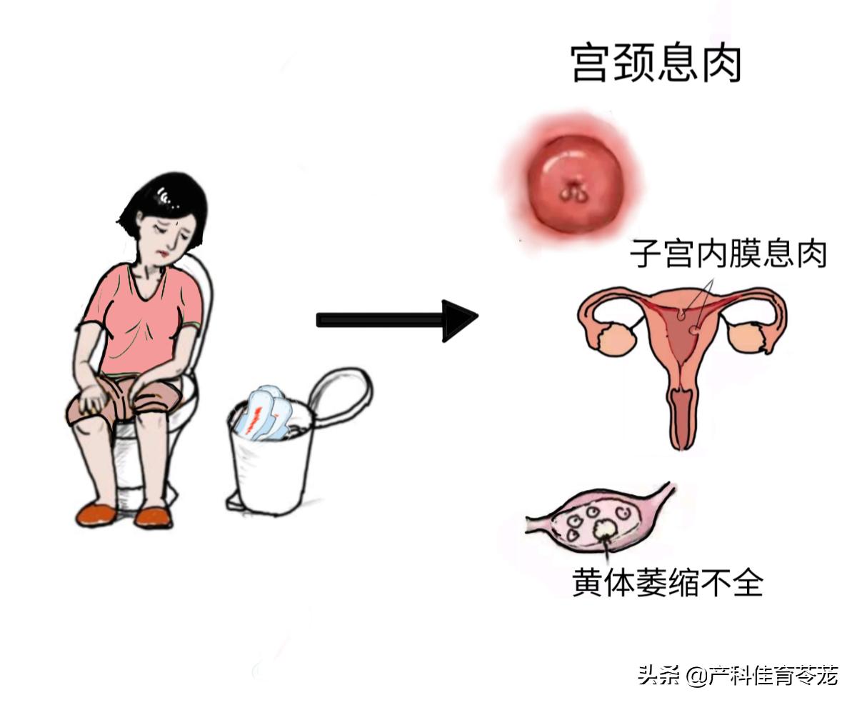 月经老不干净什么原因引起的,年龄50岁月经一直不干净