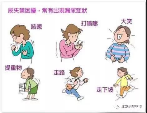 压力性重度尿失禁的表现,是什么导致压力性尿失禁