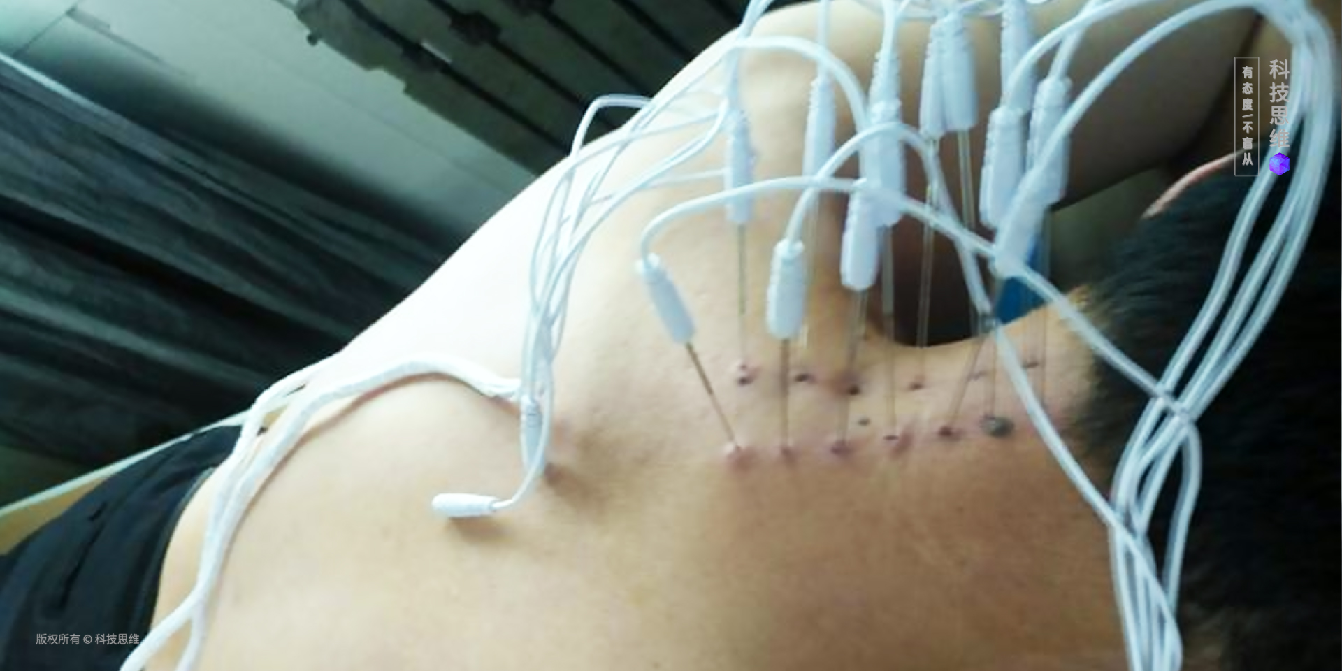 医生告诉我要配合颈椎病的治疗，于是我买了这把人体工学椅，挺好