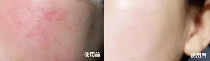 韩国小灯泡美白精华怎么样,韩国小灯泡精华抗皱效果