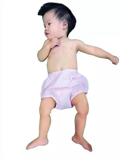 记录宝宝成长日记之掉牙,宝宝成长日记时光飞逝