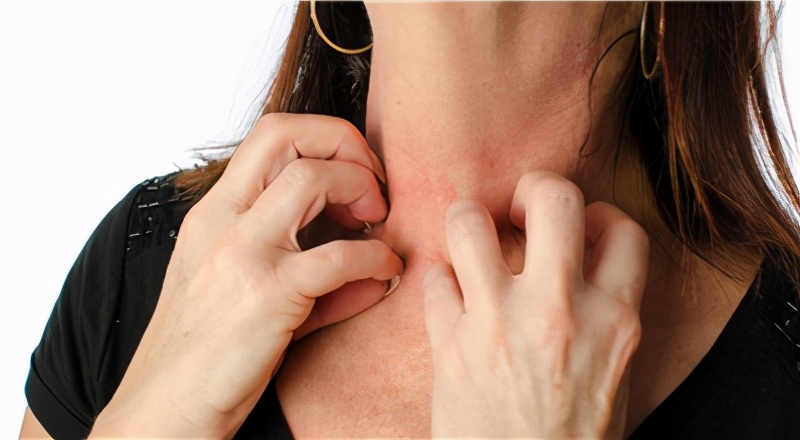 挠痒快速止痒的方法,挠痒快速止痒方法