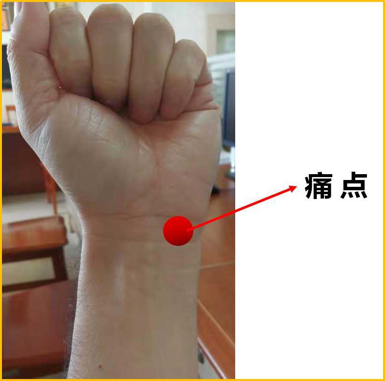 手腕、胳膊疼痛难忍，久治不愈如何破？关节骨科博士助你解烦忧