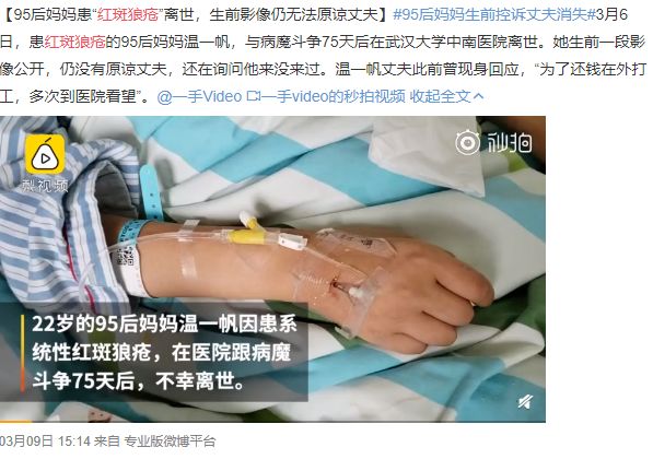 红斑狼疮有可能一辈子是轻微的吗,红斑狼疮为什么难控制