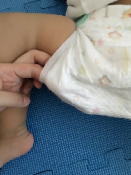 宝宝拉屎漏尿正确方法,宝宝红屁屁漏尿怎么回事