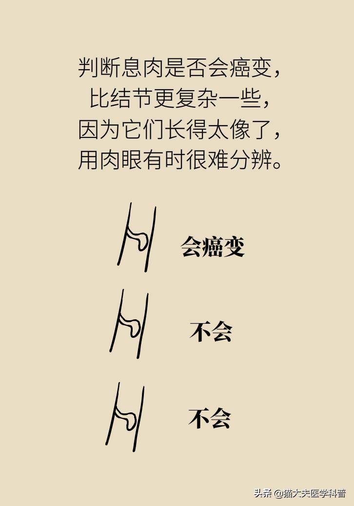 结节囊肿息肉的区别,结节增生囊肿息肉哪种癌前病变